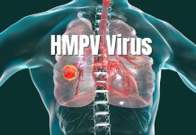 Surto de metapneumovírus (HMPV) causa preocupação na China 5 anos após a COVID-19; entenda a doença Surto de metapneumovírus (HMPV) causa preocupação na China 5 anos após a COVID-19; entenda a doença
