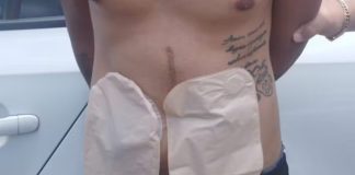 Ladrão com bolsas de colostomia rouba caminhonete de R$ 140 mil em MG Ladrão com bolsas de colostomia rouba caminhonete de R$ 140 mil em MG