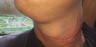 Motociclista fica gravemente ferido ao ter pescoço cortado por fio solto de poste em Uberlândia Motociclista fica gravemente ferido ao ter pescoço cortado por fio solto de poste em Uberlândia