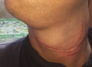 Motociclista fica gravemente ferido ao ter pescoço cortado por fio solto de poste em Uberlândia Motociclista fica gravemente ferido ao ter pescoço cortado por fio solto de poste em Uberlândia