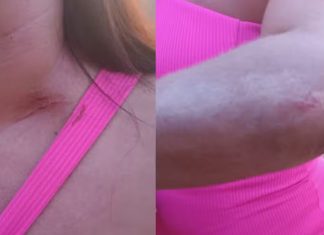 Homem Agride Mulher com Rodo e a Esgana Durante Discussão por Ciúmes em João Pinheiro Homem Agride Mulher com Rodo e a Esgana Durante Discussão por Ciúmes em João Pinheiro