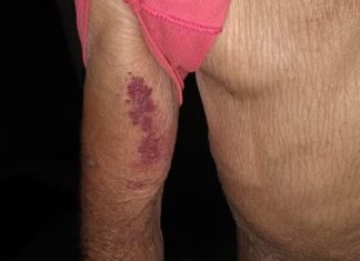 Idoso de 81 anos busca abrigo na casa de vizinhos após ser agredido e arrastado pela esposa embriagada em MG Idoso de 81 anos busca abrigo na casa de vizinhos após ser agredido e arrastado pela esposa embriagada em MG