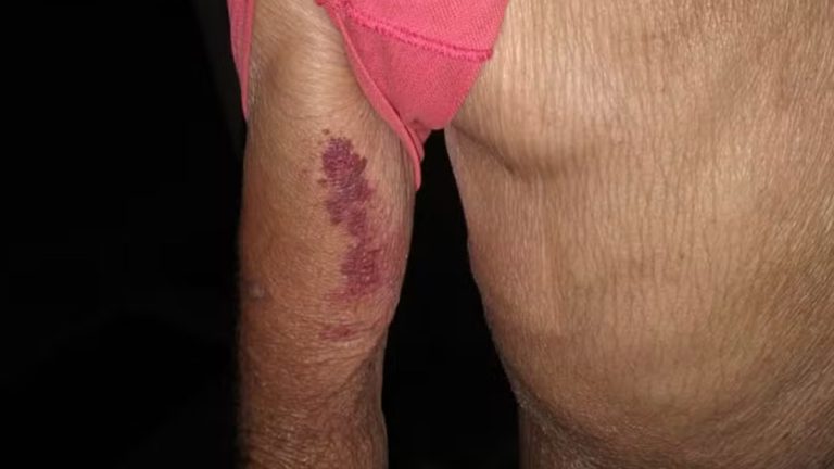 Idoso de 81 anos busca abrigo na casa de vizinhos após ser agredido e arrastado pela esposa embriagada em MG