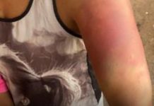 Mulher denuncia agressões e sequestro após briga por ciúmes em Uberlândia Mulher denuncia agressões e sequestro após briga por ciúmes em Uberlândia