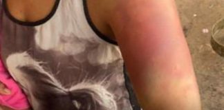 Mulher denuncia agressões e sequestro após briga por ciúmes em Uberlândia Mulher denuncia agressões e sequestro após briga por ciúmes em Uberlândia