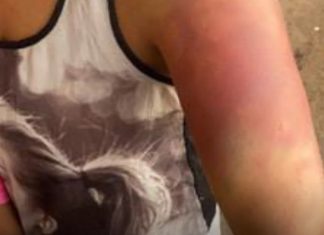 Mulher denuncia agressões e sequestro após briga por ciúmes em Uberlândia Mulher denuncia agressões e sequestro após briga por ciúmes em Uberlândia