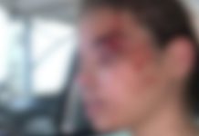 Adolescente é agredida com socos, chutes e mordida no rosto em condomínio de Uberlândia Adolescente é agredida com socos, chutes e mordida no rosto em condomínio de Uberlândia