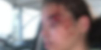 Adolescente é agredida com socos, chutes e mordida no rosto em condomínio de Uberlândia Adolescente é agredida com socos, chutes e mordida no rosto em condomínio de Uberlândia