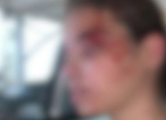 Adolescente é agredida com socos, chutes e mordida no rosto em condomínio de Uberlândia Adolescente é agredida com socos, chutes e mordida no rosto em condomínio de Uberlândia