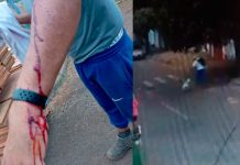 Homem é agredido por pitbull solto em rua de Uberlândia Homem é agredido por pitbull solto em rua de Uberlândia