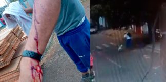 Homem é agredido por pitbull solto em rua de Uberlândia Homem é agredido por pitbull solto em rua de Uberlândia