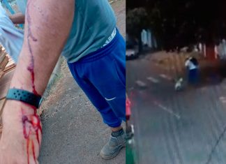Homem é agredido por pitbull solto em rua de Uberlândia Homem é agredido por pitbull solto em rua de Uberlândia