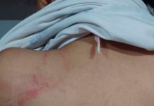 Mãe Agride Filha de 8 Anos com Mangueira Durante Dever de Casa Mãe Agride Filha de 8 Anos com Mangueira Durante Dever de Casa