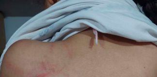 Mãe Agride Filha de 8 Anos com Mangueira Durante Dever de Casa Mãe Agride Filha de 8 Anos com Mangueira Durante Dever de Casa