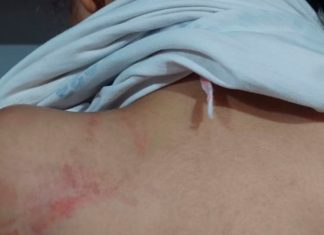 Mãe Agride Filha de 8 Anos com Mangueira Durante Dever de Casa Mãe Agride Filha de 8 Anos com Mangueira Durante Dever de Casa
