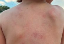Mãe Relata Violência Contra Filho Autista na Apae de Ituiutaba Mãe Relata Violência Contra Filho Autista na Apae de Ituiutaba