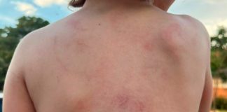 Mãe Relata Violência Contra Filho Autista na Apae de Ituiutaba Mãe Relata Violência Contra Filho Autista na Apae de Ituiutaba