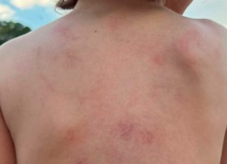 Mãe Relata Violência Contra Filho Autista na Apae de Ituiutaba Mãe Relata Violência Contra Filho Autista na Apae de Ituiutaba