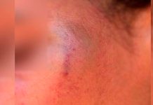 Padrasto Agride Adolescente em Patos de Minas; Mãe Intervém e Evita Tragédia Padrasto Agride Adolescente em Patos de Minas; Mãe Intervém e Evita Tragédia