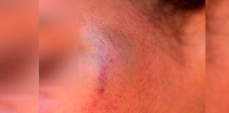 Padrasto Agride Adolescente em Patos de Minas; Mãe Intervém e Evita Tragédia Padrasto Agride Adolescente em Patos de Minas; Mãe Intervém e Evita Tragédia