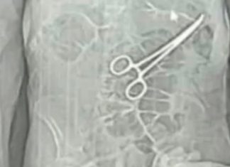 Erro Médico: Idoso Perde a Vida em João Pinheiro Após Pinça Cirúrgica Ser Esquecida Erro Médico: Idoso Perde a Vida em João Pinheiro Após Pinça Cirúrgica Ser Esquecida