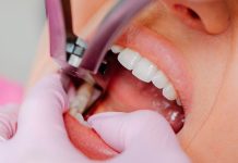 Paciente em Uberlândia Sofre Extração de Dente Errado e Indenização é Negada Paciente em Uberlândia Sofre Extração de Dente Errado e Indenização é Negada