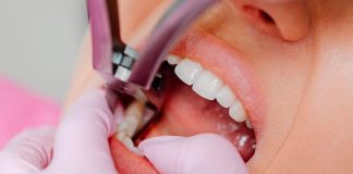 Paciente em Uberlândia Sofre Extração de Dente Errado e Indenização é Negada Paciente em Uberlândia Sofre Extração de Dente Errado e Indenização é Negada