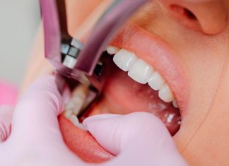 Paciente em Uberlândia Sofre Extração de Dente Errado e Indenização é Negada Paciente em Uberlândia Sofre Extração de Dente Errado e Indenização é Negada