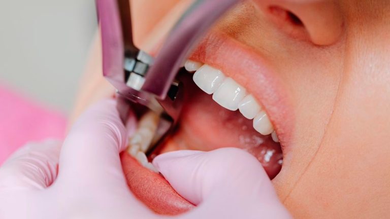 Paciente em Uberlândia Sofre Extração de Dente Errado e Indenização é Negada
