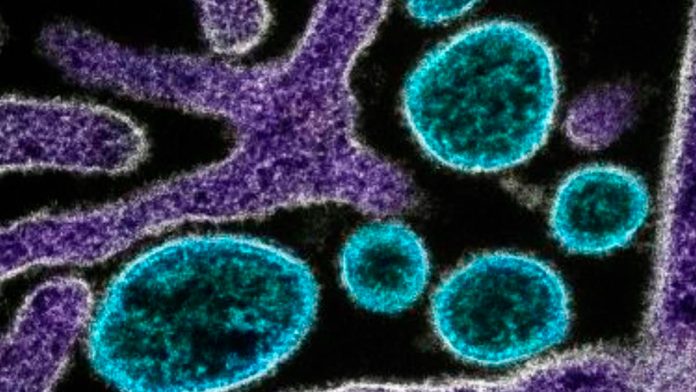 Surto do vírus Nipah na Índia gera alerta de saúde